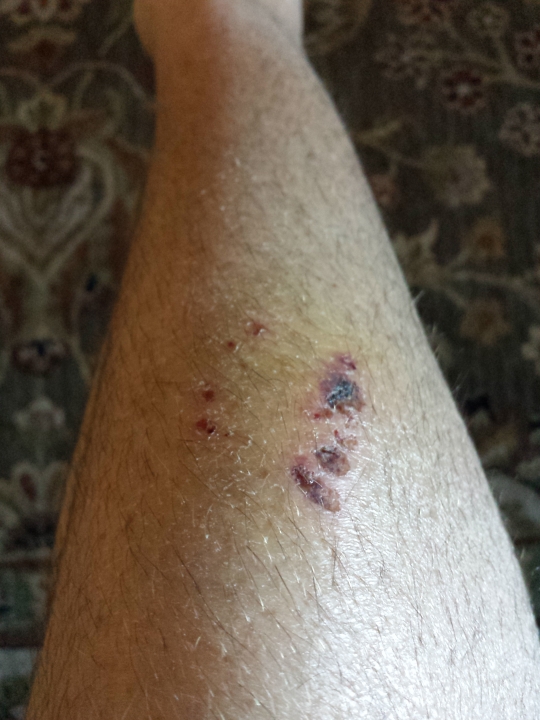 Three days later, both rows of teeth still visible